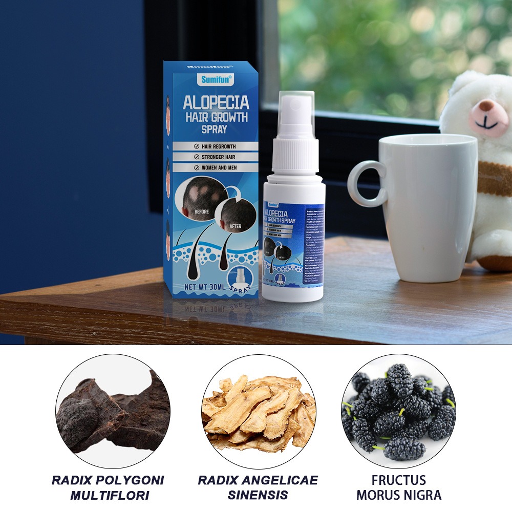 Alopecia Spray para el crecimi - Hair Care Spray reseña y precio