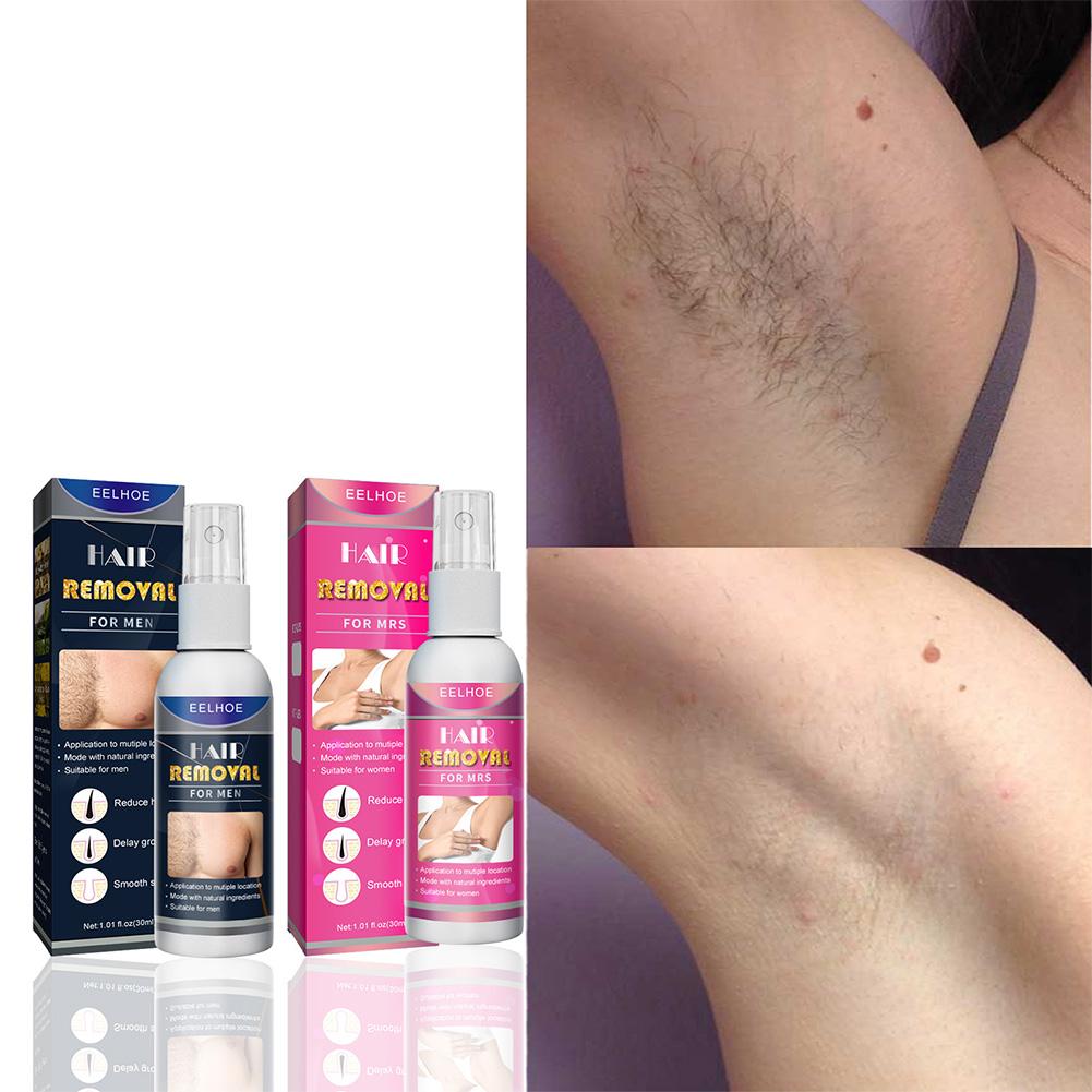1/2 Uds. Depiladora permanente - Hair Care Spray reseña y precio